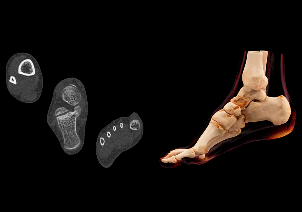 Anatomy of the ankle and foot: Labeled normal CT - e-Anatomy