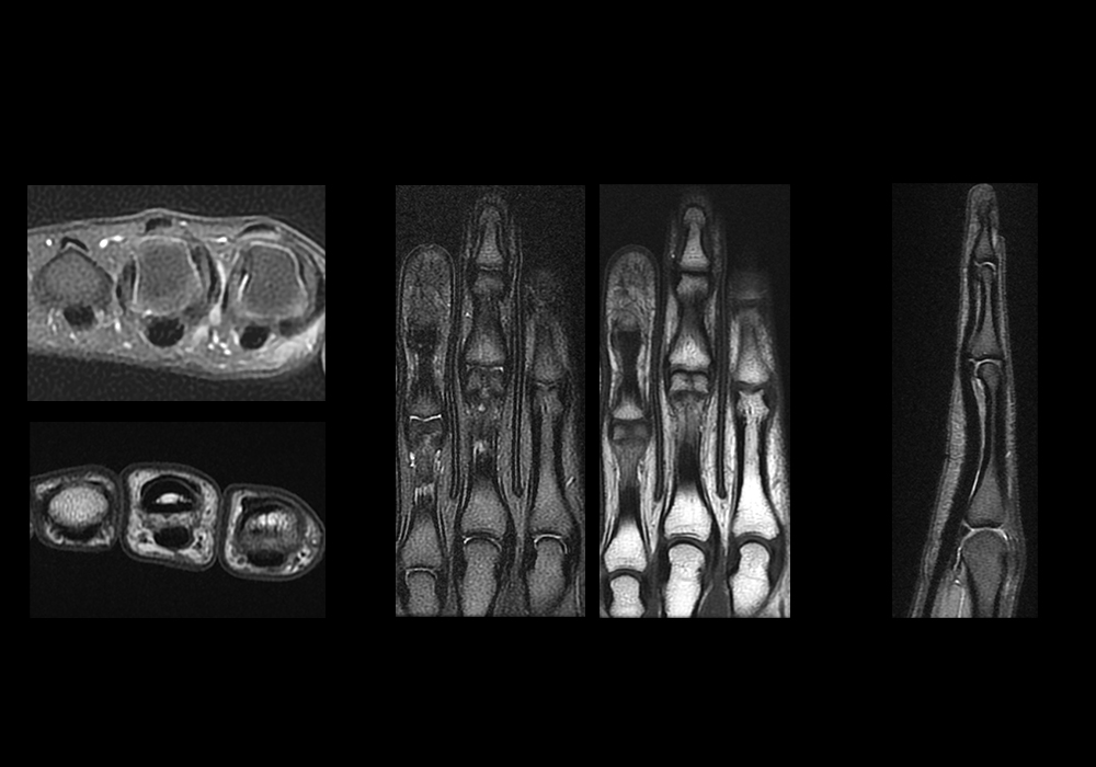 Anatomy of the finger: annotated MRI | e-Anatomy