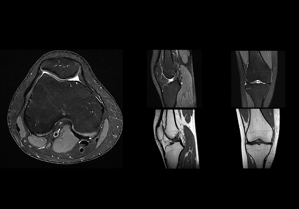 Anatomy of the knee: labeled MRI - e-Anatomy