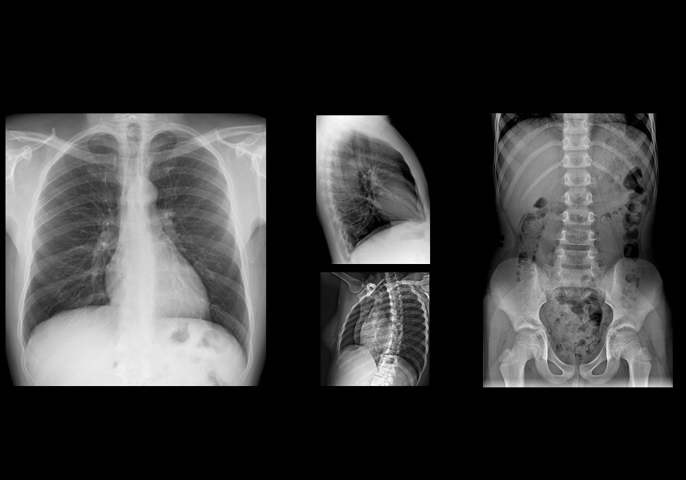 Radiografias do tórax e abdome-pelve: radiografias normais com legendas ...